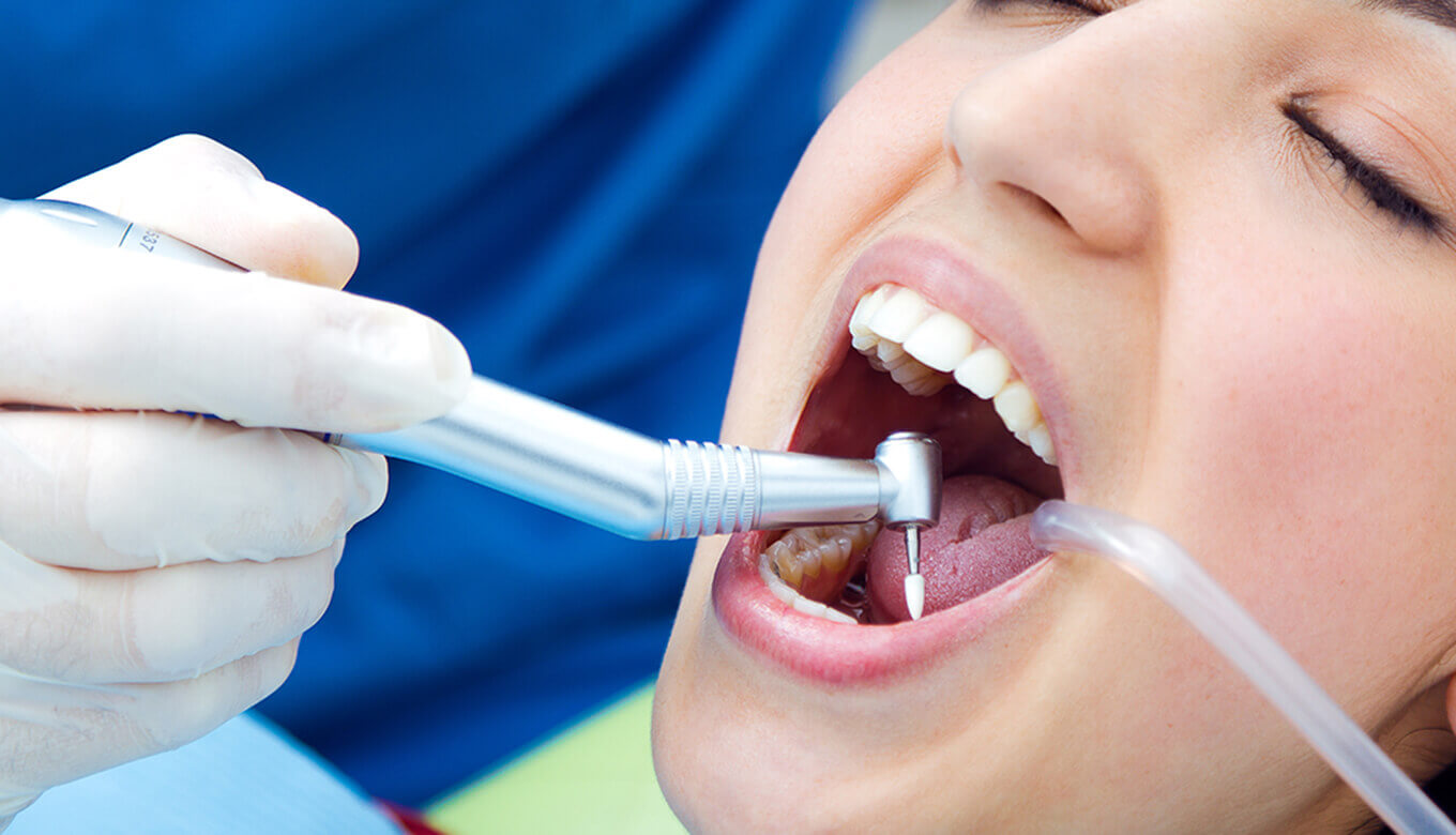 What Is Deep Teeth Cleaning?