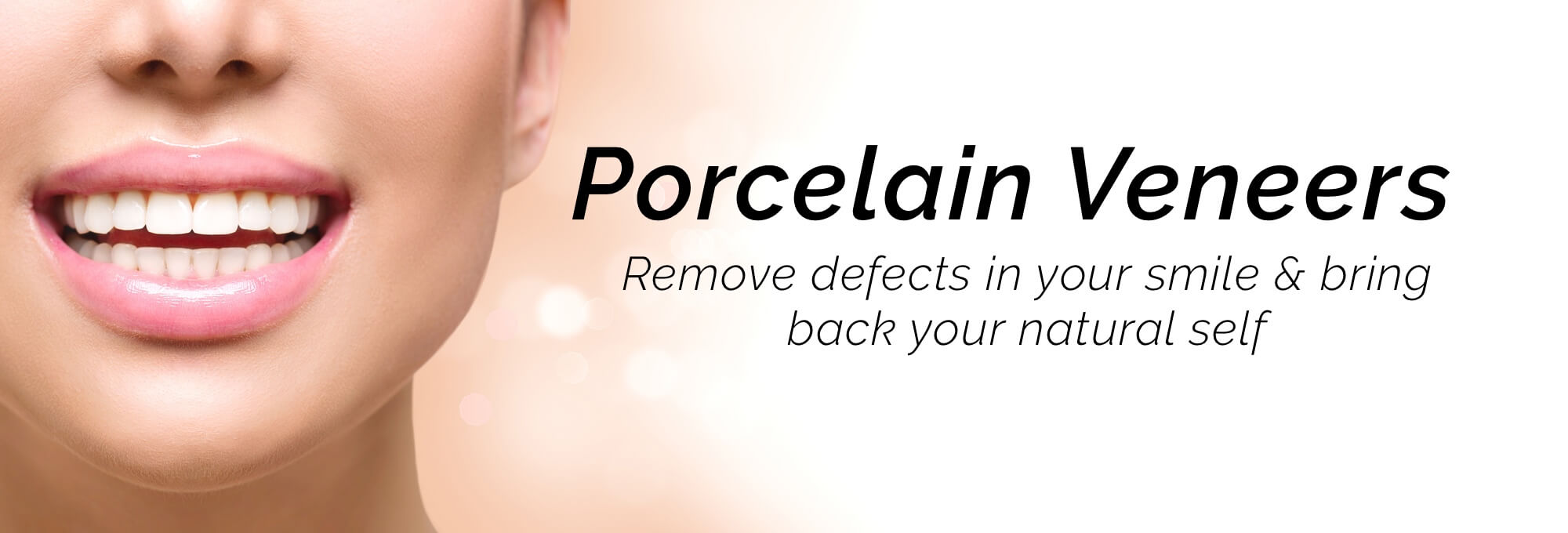 porcelain veneers