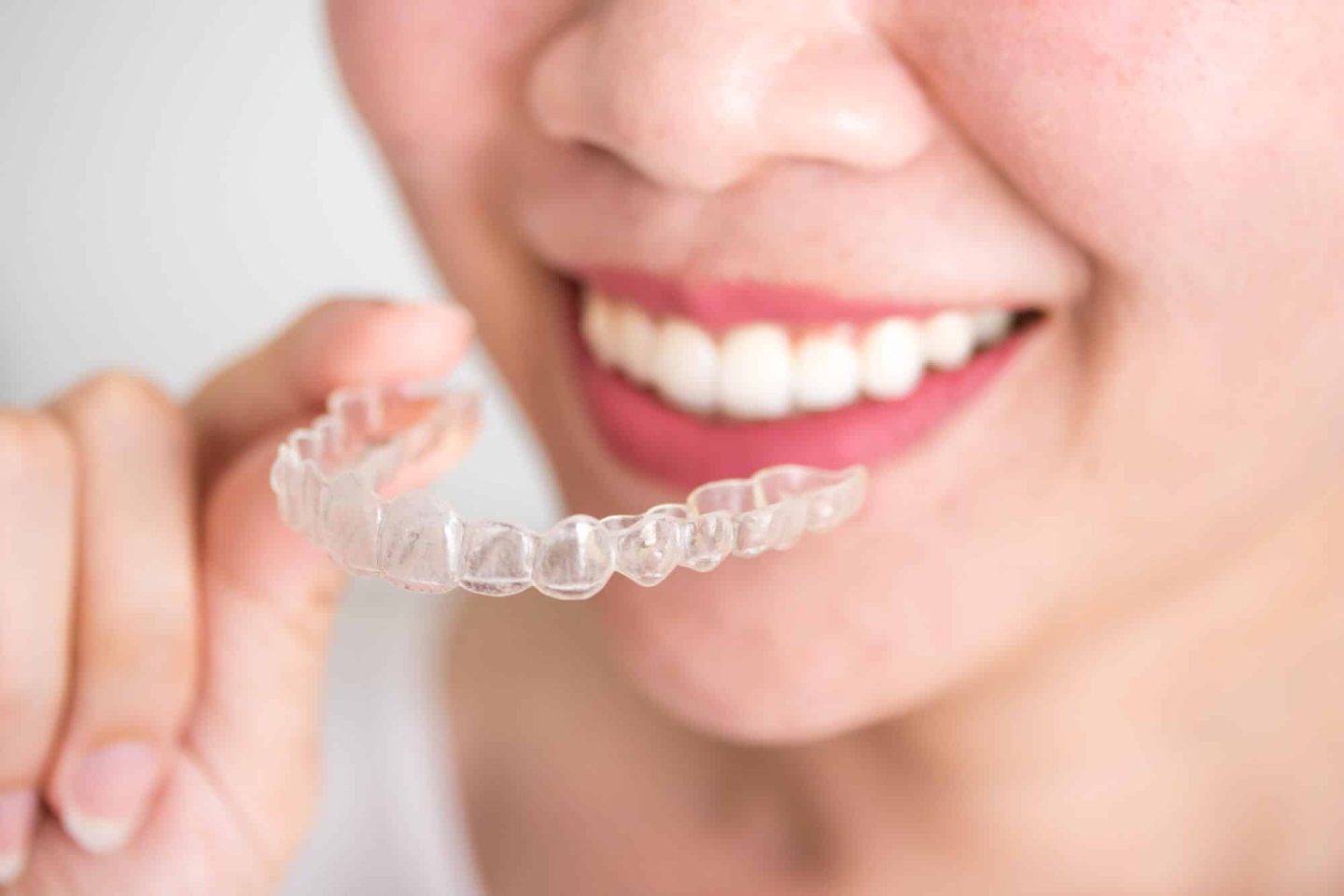 How Does Invisalign Work?